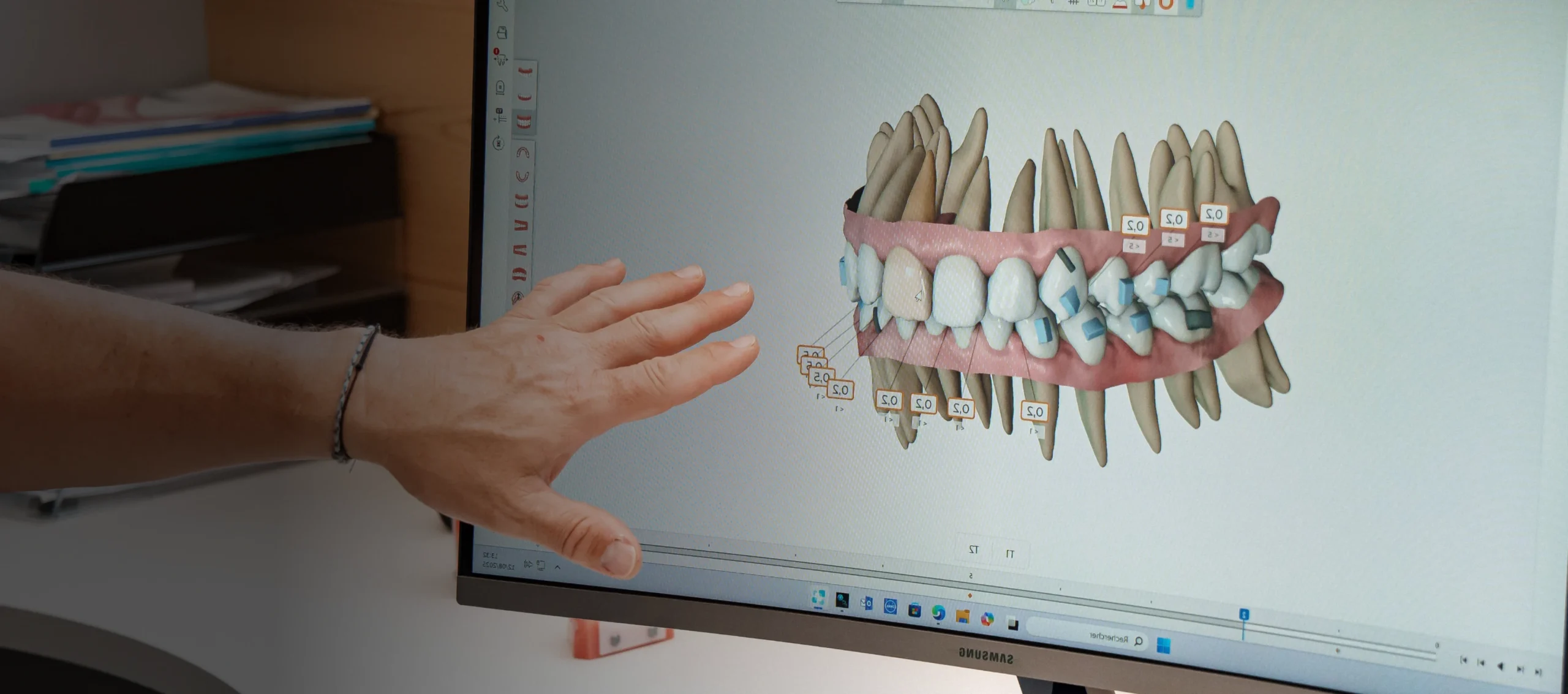 orthodontie douvaine technologies scaled